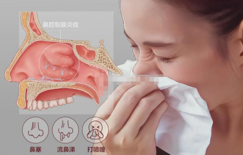 清鼻堂：鼻炎的类型有很多，应该怎样分辨？